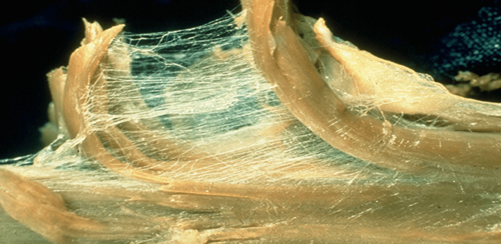 Osteopatía miofascial